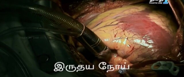 Moviesda.Mobi - Iru Vizhi Oru Paarvai 2024 Original 720p HD.mp4